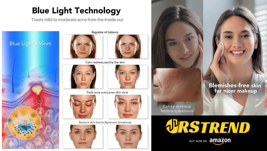 NEWKEY Blue Light Therapy Mask for Acne & Wrinkles